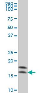 NME2 Antibody in Western Blot (WB)