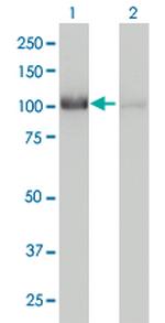 CNOT3 Antibody in Western Blot (WB)