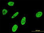 NOTCH3 Antibody in Immunocytochemistry (ICC/IF)