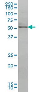 NR4A2 Antibody in Western Blot (WB)