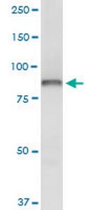 OSBP Antibody in Western Blot (WB)