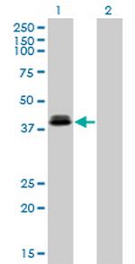 OTX1 Antibody in Western Blot (WB)
