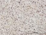 PAX2 Antibody in Immunohistochemistry (Paraffin) (IHC (P))