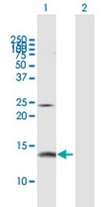 PFN2 Antibody in Western Blot (WB)