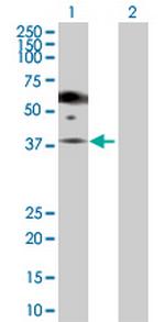 PGA5 Antibody in Western Blot (WB)