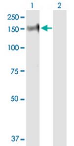 PHKA2 Antibody in Western Blot (WB)