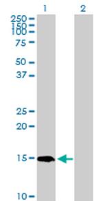 PIN4 Antibody in Western Blot (WB)