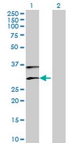 PLA2G1B Antibody in Western Blot (WB)