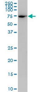 PLS1 Antibody in Western Blot (WB)