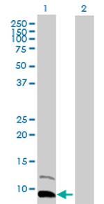 PPBP Antibody in Western Blot (WB)