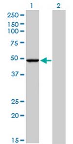 PPOX Antibody in Western Blot (WB)