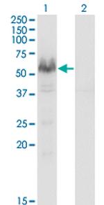 PPP3CA Antibody in Western Blot (WB)
