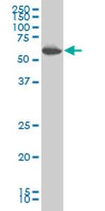 PRKAA1 Antibody in Western Blot (WB)