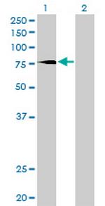 PRKCD Antibody in Western Blot (WB)