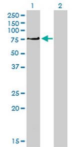 PRKCI Antibody in Western Blot (WB)