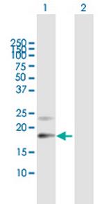 PTGDS Antibody in Western Blot (WB)