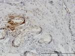 PTK9 Antibody in Immunohistochemistry (Paraffin) (IHC (P))