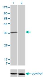 RAD1 Antibody in Western Blot (WB)