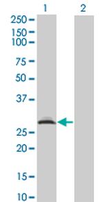 RAD1 Antibody in Western Blot (WB)