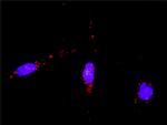 RAD51 Antibody in Proximity Ligation Assay (PLA) (PLA)