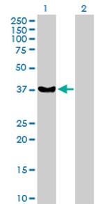 RAD51 Antibody in Western Blot (WB)