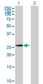 RAD51L3 Antibody in Western Blot (WB)
