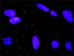 RALGDS Antibody in Proximity Ligation Assay (PLA) (PLA)