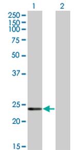 RCV1 Antibody in Western Blot (WB)