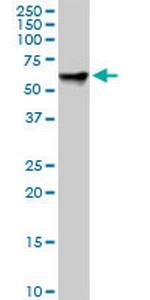 RDX Antibody in Western Blot (WB)