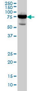 RDX Antibody in Western Blot (WB)