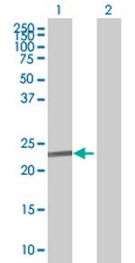 RLN1 Antibody in Western Blot (WB)