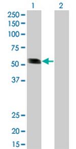 RING1 Antibody in Western Blot (WB)