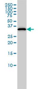 RLBP1 Antibody in Western Blot (WB)