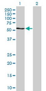 RPS6KB2 Antibody in Western Blot (WB)