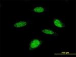 RPS6KB2 Antibody in Immunocytochemistry (ICC/IF)