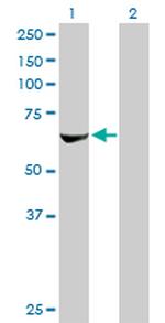 RPS6KB2 Antibody in Western Blot (WB)