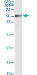 RRM2 Antibody in Immunoprecipitation (IP)