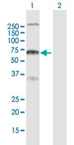 RYK Antibody in Western Blot (WB)