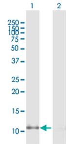 CCL2 Antibody in Western Blot (WB)