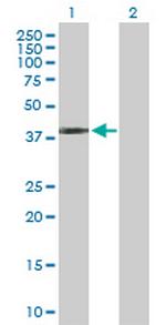 SFTPB Antibody in Western Blot (WB)