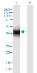 SFTPB Antibody in Western Blot (WB)