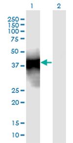 SFTPB Antibody in Western Blot (WB)