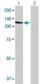 SLC4A1 Antibody in Western Blot (WB)