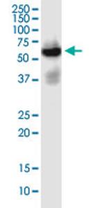 SLC22A2 Antibody in Western Blot (WB)