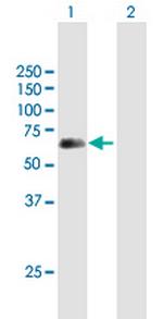 SPINT1 Antibody in Western Blot (WB)