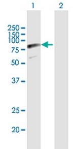 SRPR Antibody in Western Blot (WB)