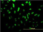 TCF4 Antibody in Immunocytochemistry (ICC/IF)