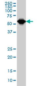 TCF3 Antibody in Western Blot (WB)