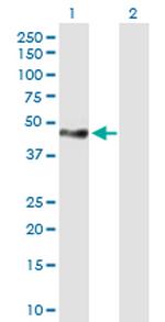 TNS1 Antibody in Western Blot (WB)