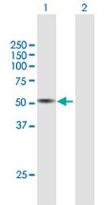 TPH1 Antibody in Western Blot (WB)